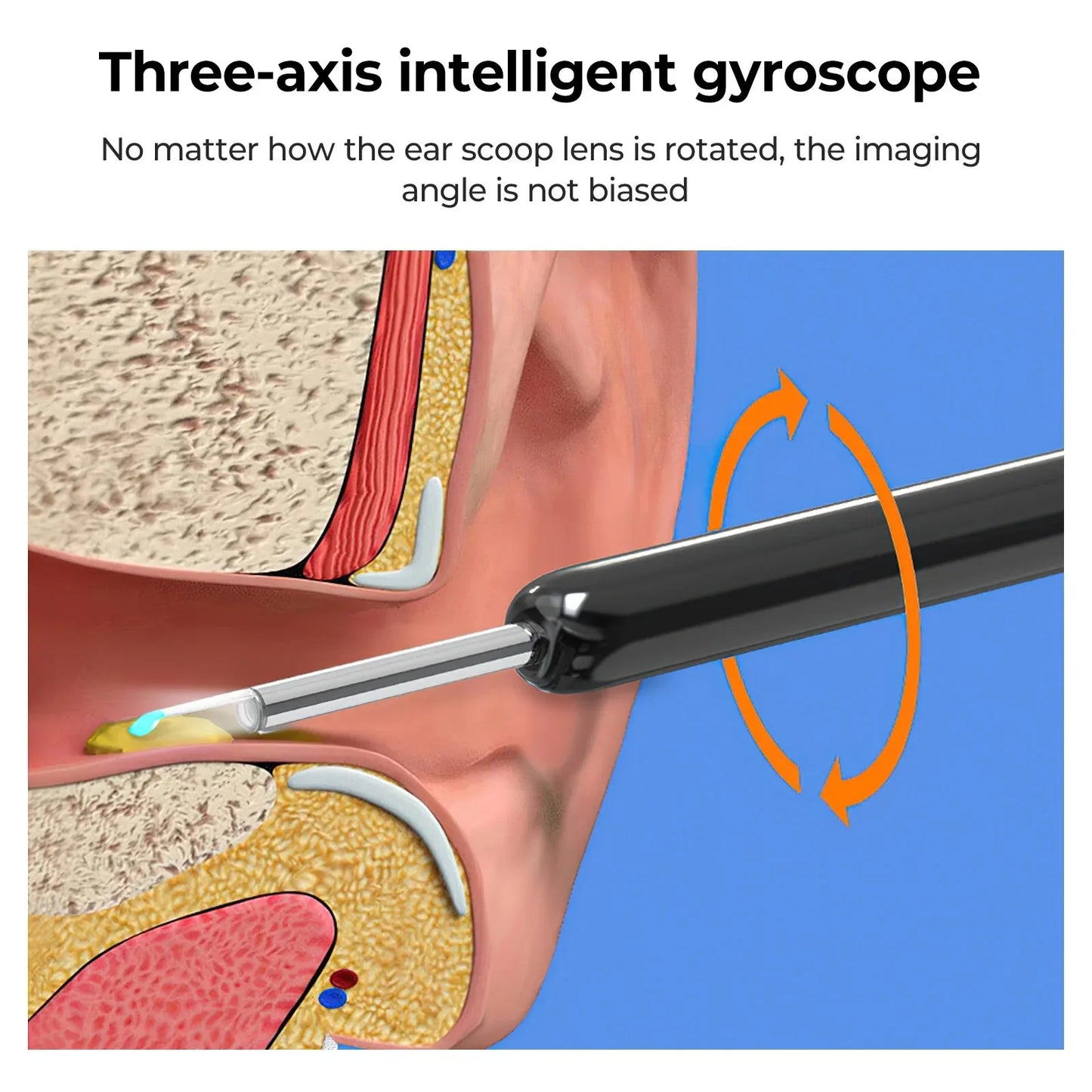 Smart Ear Cleaner: 1080P Otoscope & Ear Wax Removal Tool