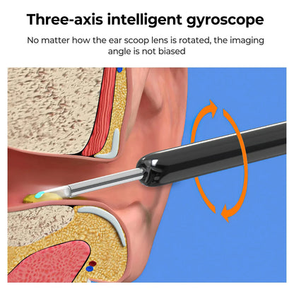 Smart Ear Cleaner: 1080P Otoscope & Ear Wax Removal Tool